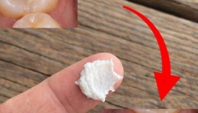 5 Simple Natural Home Remedies to Help Prevent Cavities and Support Healthy Teeth