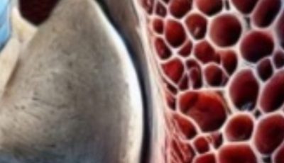 Doctors Use Castor Oil & Lemon to Solve 12 Common Health Issues in Just a Week!