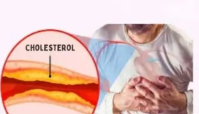 High Cholesterol: The Silent Enemy That Rarely Shows Its Face