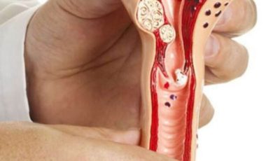 What Happens to Your Body When Intimacy Fades With Age