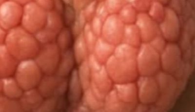 6 Simple Steps to Support Thyroid Health Naturally