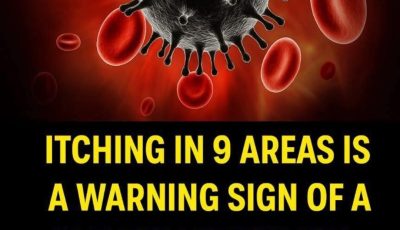 Is Itching a Sign of Cancer? What Science Really Says About “9 Itchy Areas”