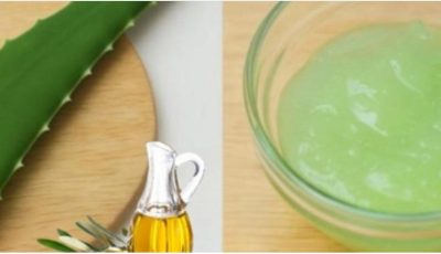 Aloe Vera for Varicose Veins and Tired Legs: Natural Relief You Can Try at Home