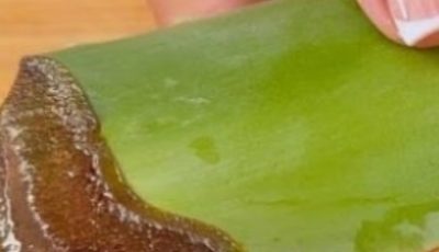 1000 Times Stronger Than Botox! Natural Collagen Aloe Vera! Erases All Wrinkles